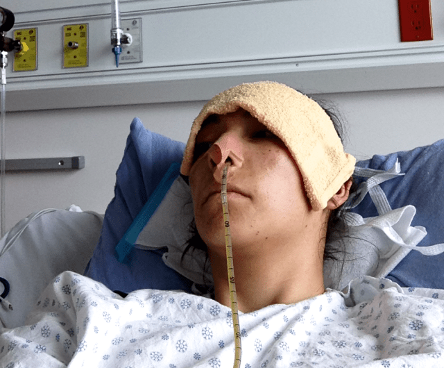 June 2013 - after having been readmitted with an assumed ileus (normal post-op complication) exploratory scope perforated bowel (because it wasn't an ileus - it was a twisted off and now dead piece of small intestine), waiting for emergency surgery. Body swollen with edema as organs begin to shut down. 